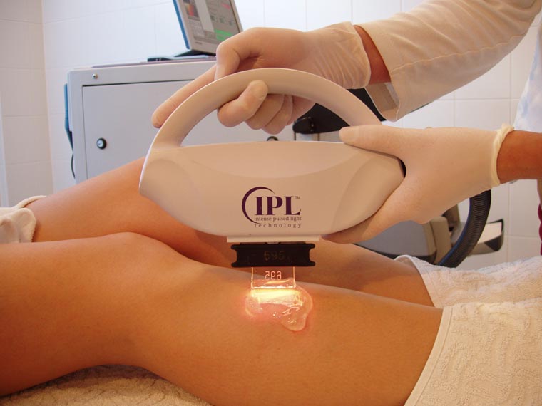 OLYMPUS DIGITAL CAMERA depilacja laserowa, golenie