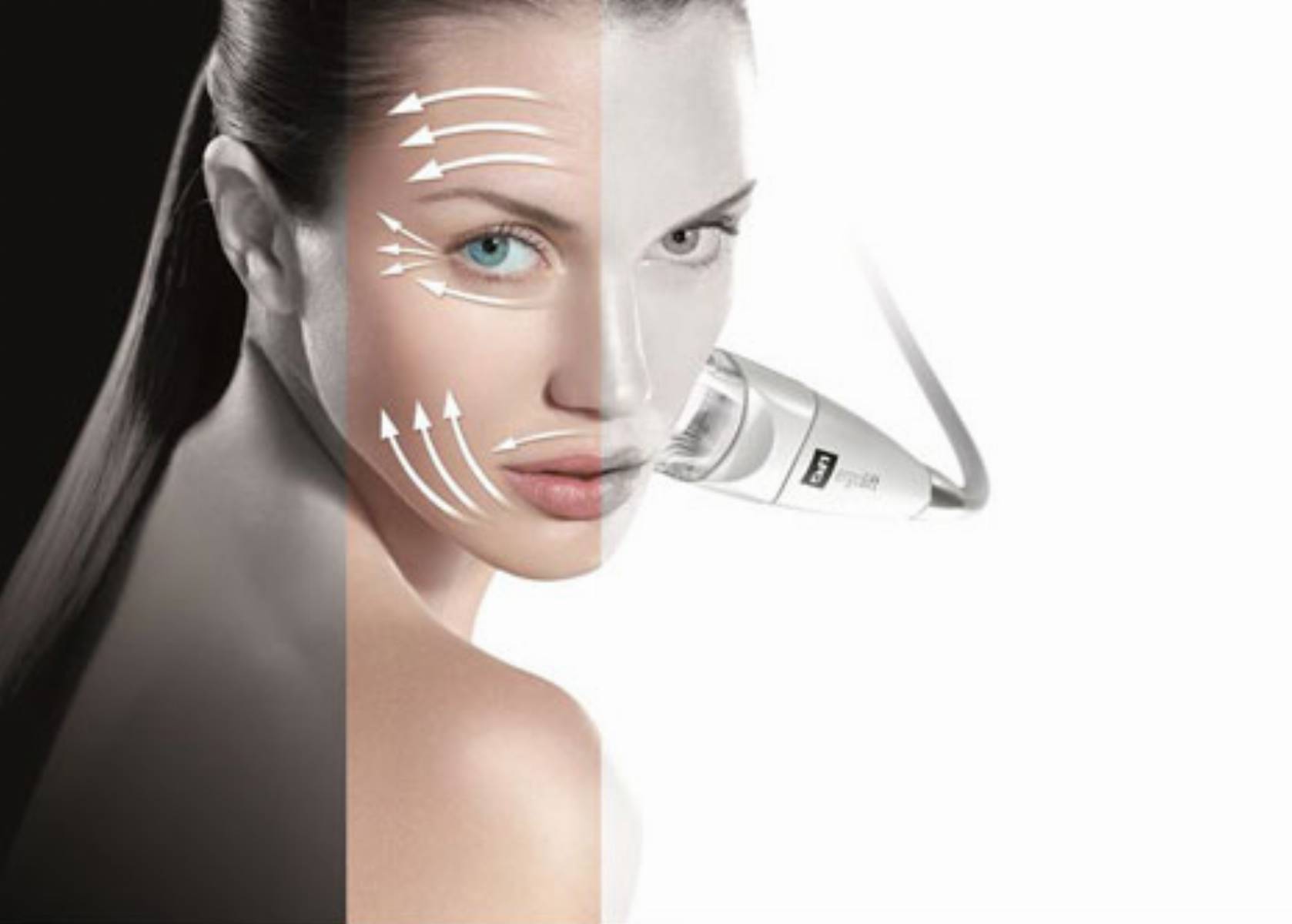 Endermolift - anti-aging