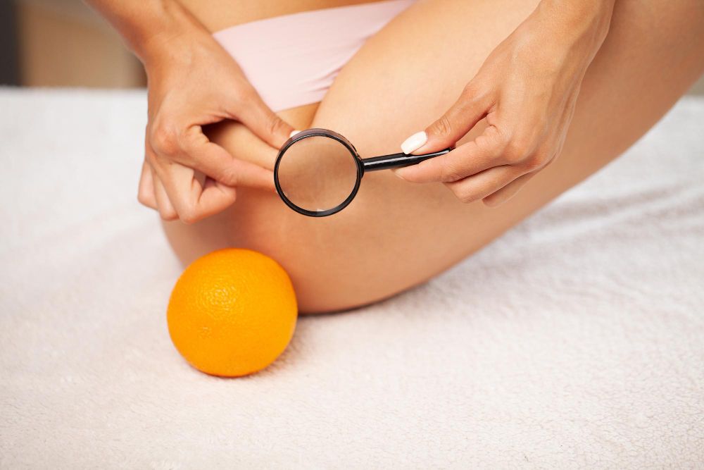 fr Jak się pozbyć cellulitu: skuteczne kosmetyki na pomarańczową skórkę
