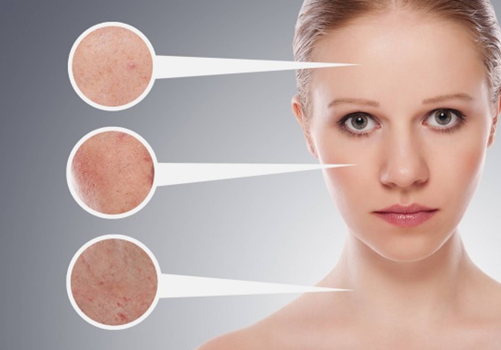 concept skincare. Skin of beauty young woman before and after th