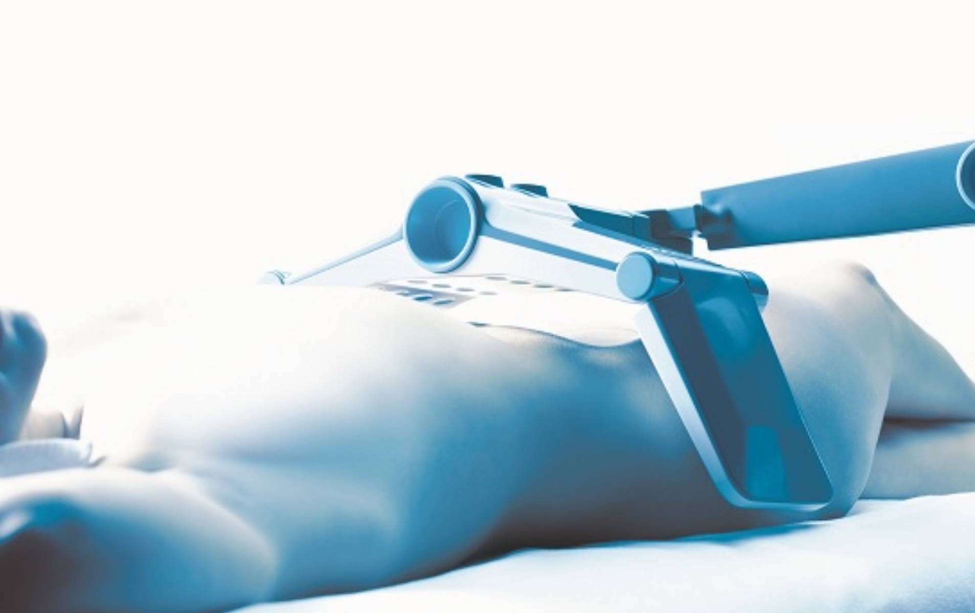 Zabieg urzadzeniem VANQUISH