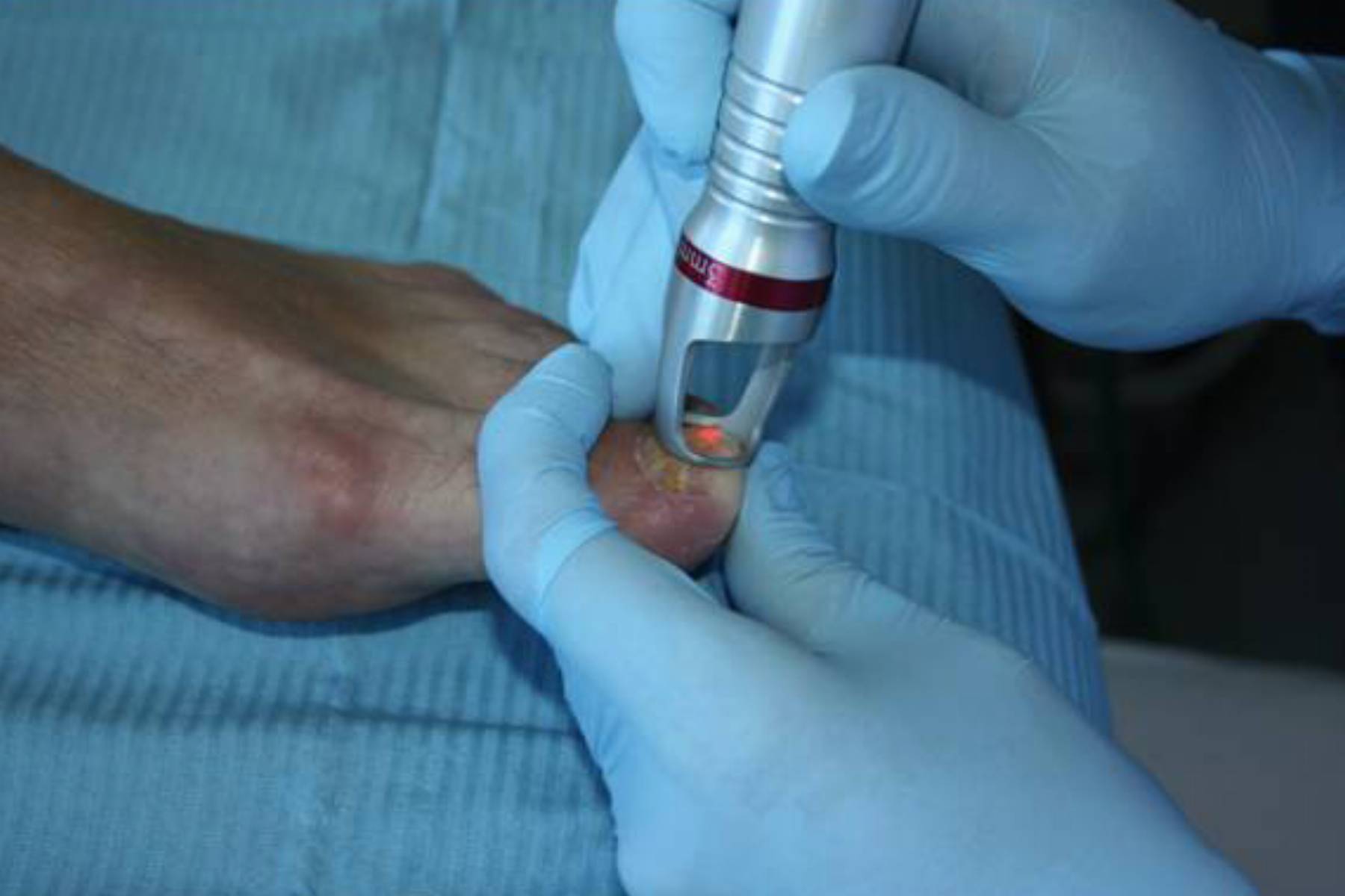 W trakcie zabiegu fot. Shar-pol