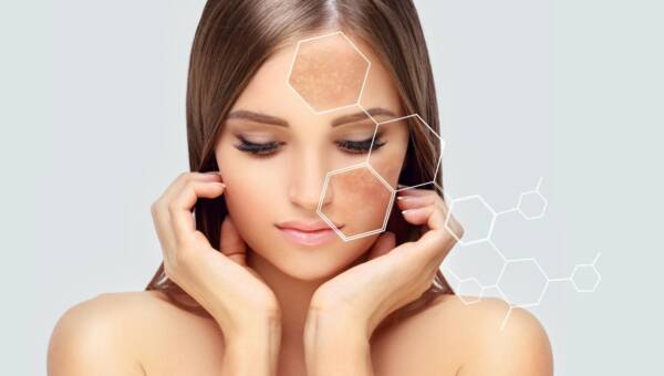 kwas hialuronowy na skórę