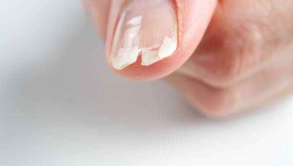 zmiany na paznokciach