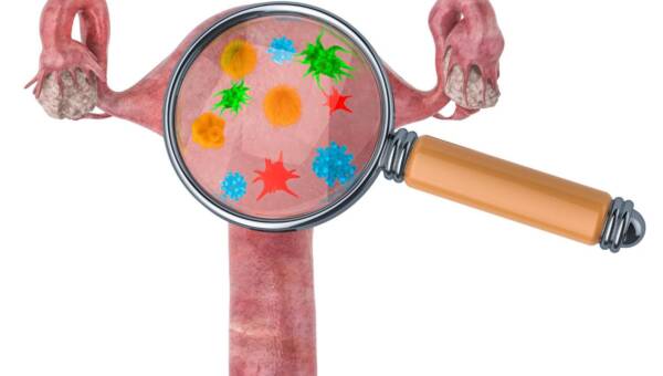 chlamydia
