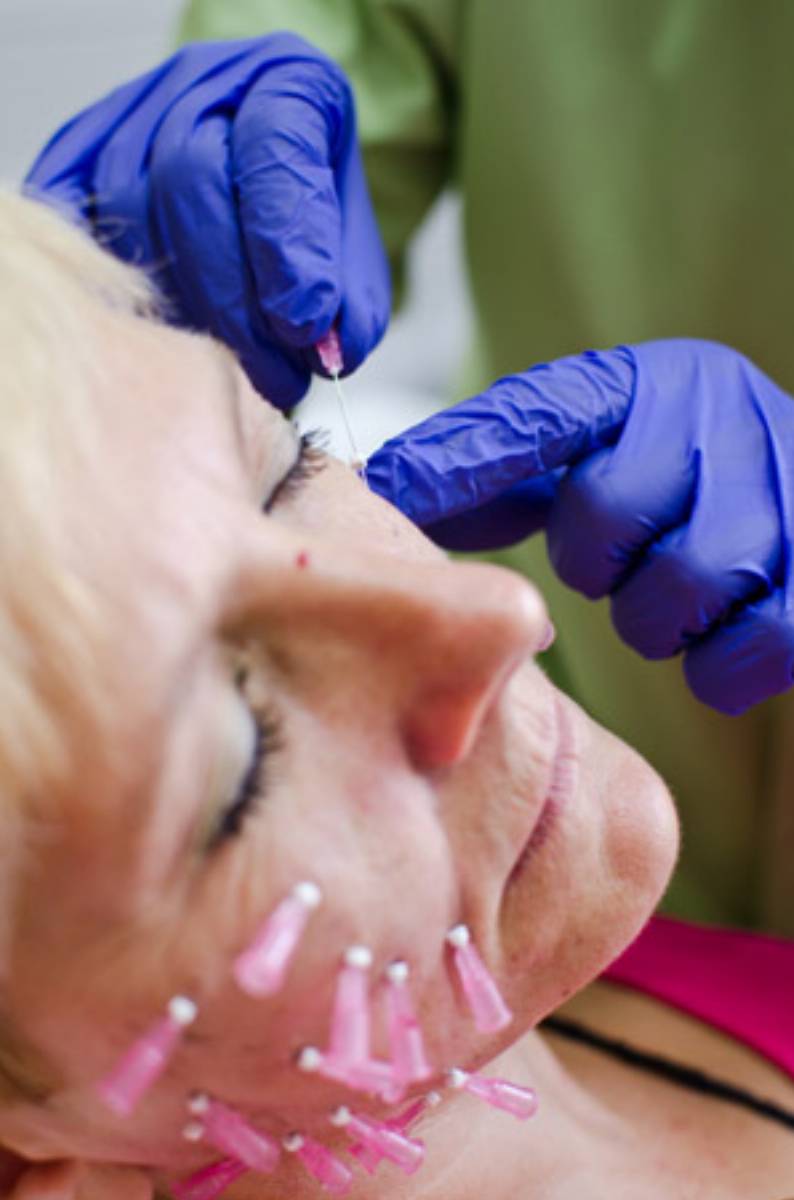 smart lifting (nici liftingujące) w Triclinium, fot. Triclinium