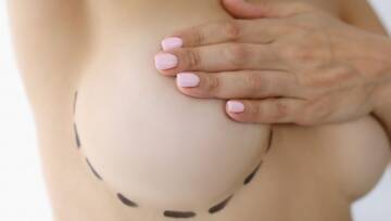 przed powiększaniem piersi