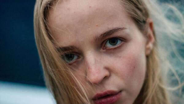 młodzieńczy trądzik