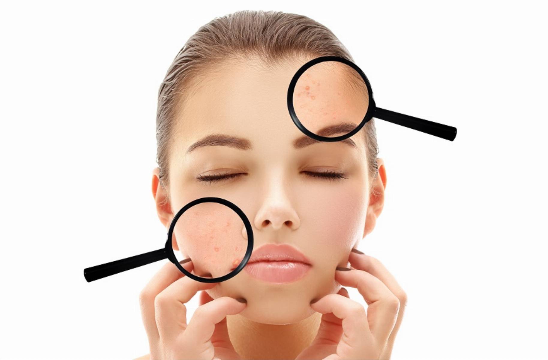 Portrait of girl with problem and clear skin,