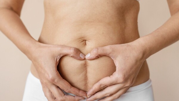 zmiany po porodzie na ciele kobiety