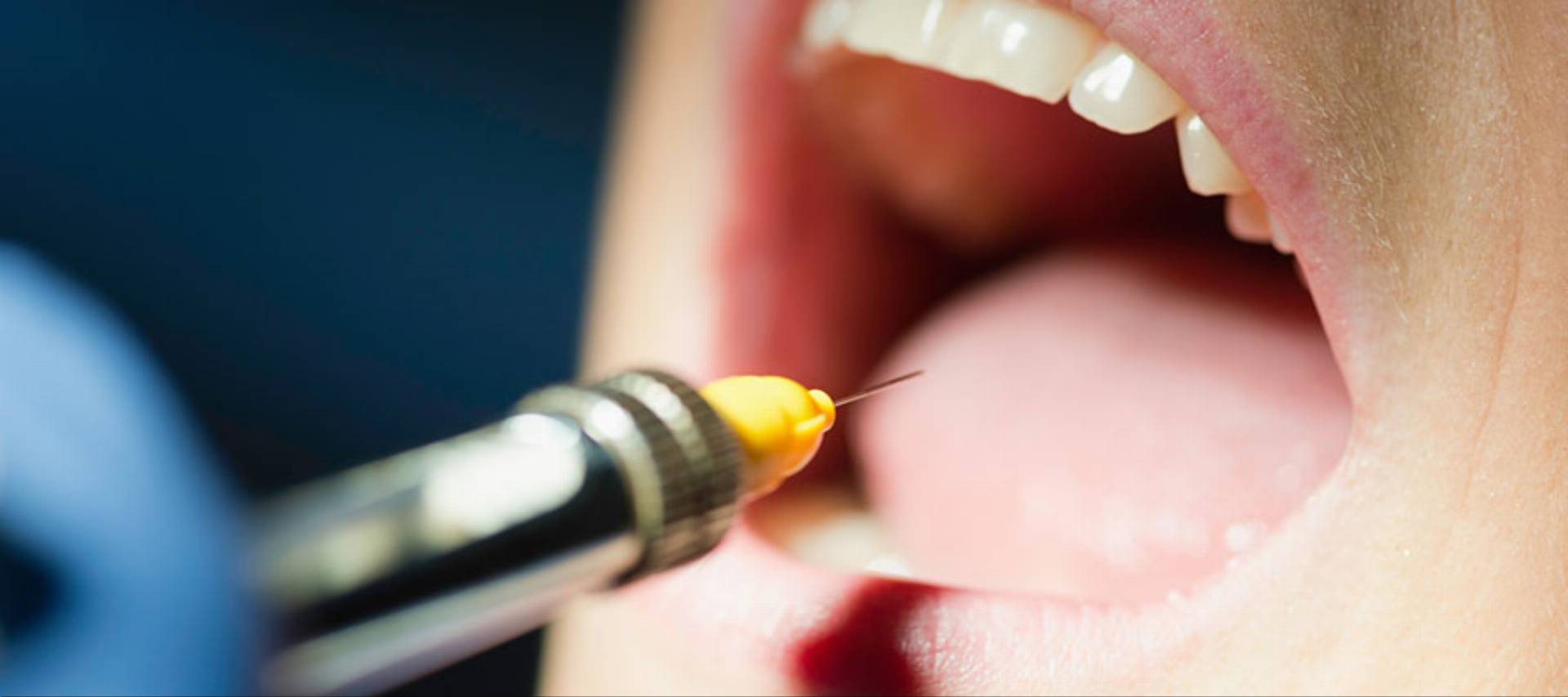 Dental anesthetic syringe