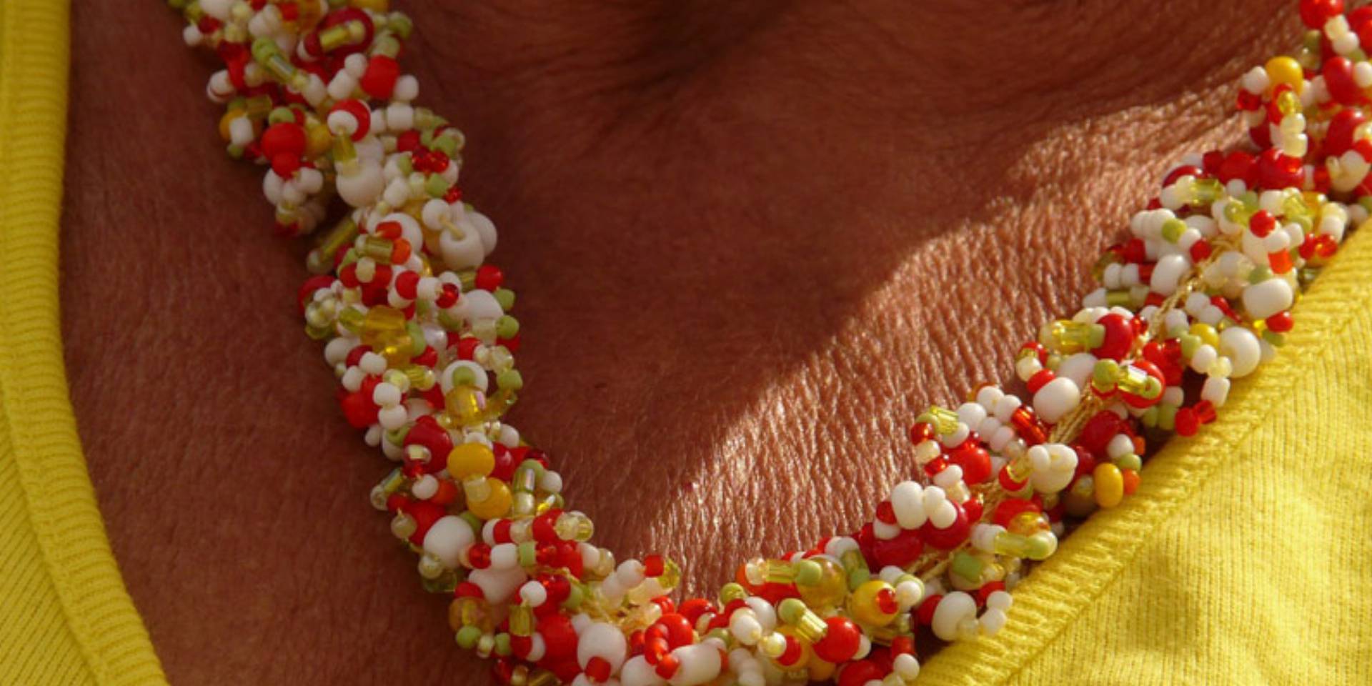 skóra-z-przebarwieniami