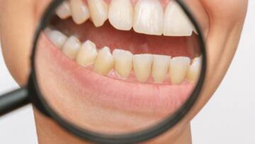 zęby z płytką nazębną