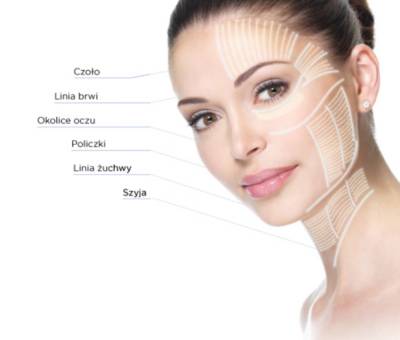 HIFU - lifting twarzy bez skalpela