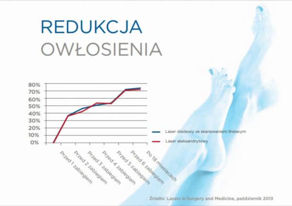 redukcja owłosienia infografika