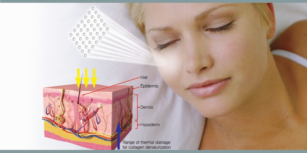 poprawa jakości skóry