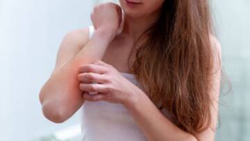 atopowe zapalenie skóry u kobiety