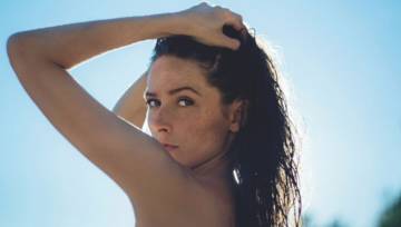 przebarwienia skóry