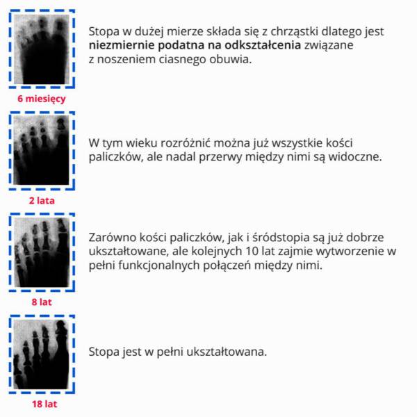 Zdjęcia rentgenowskie stopy począwszy od stopy u sześciomiesięcznego dziecka do stopy osiemnastolatka