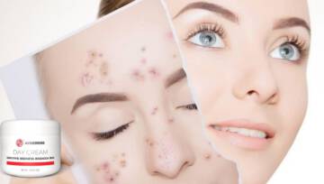 maść na trądzik baner