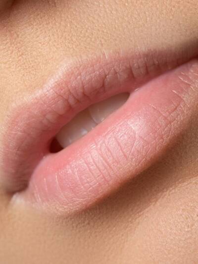 trend 2022 invisi lips trend 2022 invisi lips