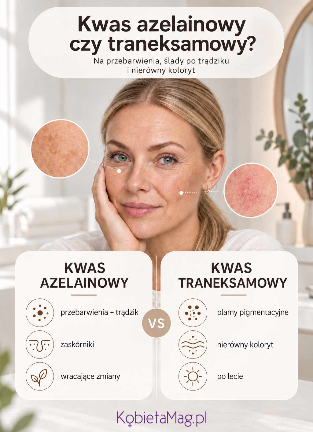 kwas traneksamowy a kwas azelainowy na przebarwienia i ślady po trądziku - infografika
